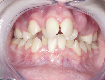 Hertog Draak Haringen Tandartspraktijk Elahi – Orthodontie
